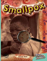 Picture of Smallpox