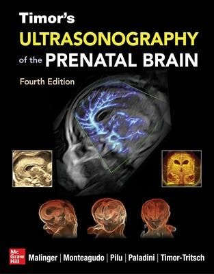 Picture of Timor's Ultrasonography of the Prenatal Brain, Fourth Edition