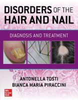 Picture of Disorders of the Hair and Nail: Diagnosis and Treatment