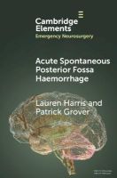 Picture of Acute Spontaneous Posterior Fossa Haemorrhage