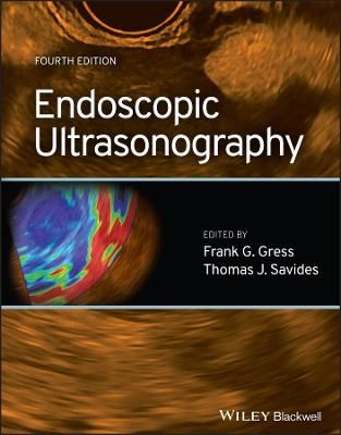 Picture of Endoscopic Ultrasonography