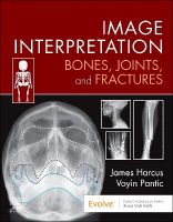 Picture of Image Interpretation: Bones, Joints, and Fractures